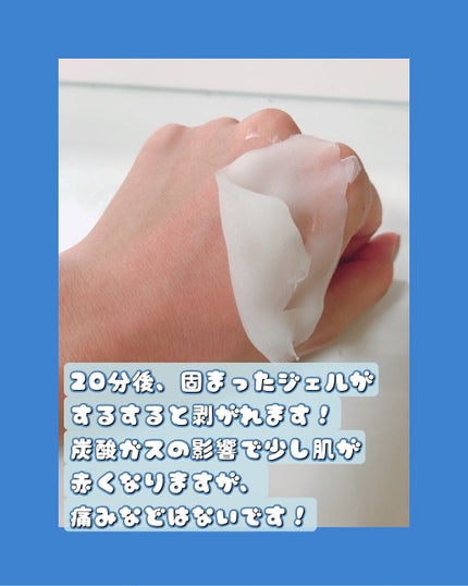 炭酸パック プルリ/ウツクシア/洗い流すパック・マスクを使ったクチコミ(7枚目)