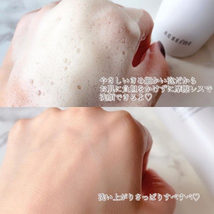 ãªã»ãã ãŠã©ãã·ã¥/ACSEINE/泡æŽé¡ã䜿ã£ãã¯ãã³ãïŒ3æç®ïŒ