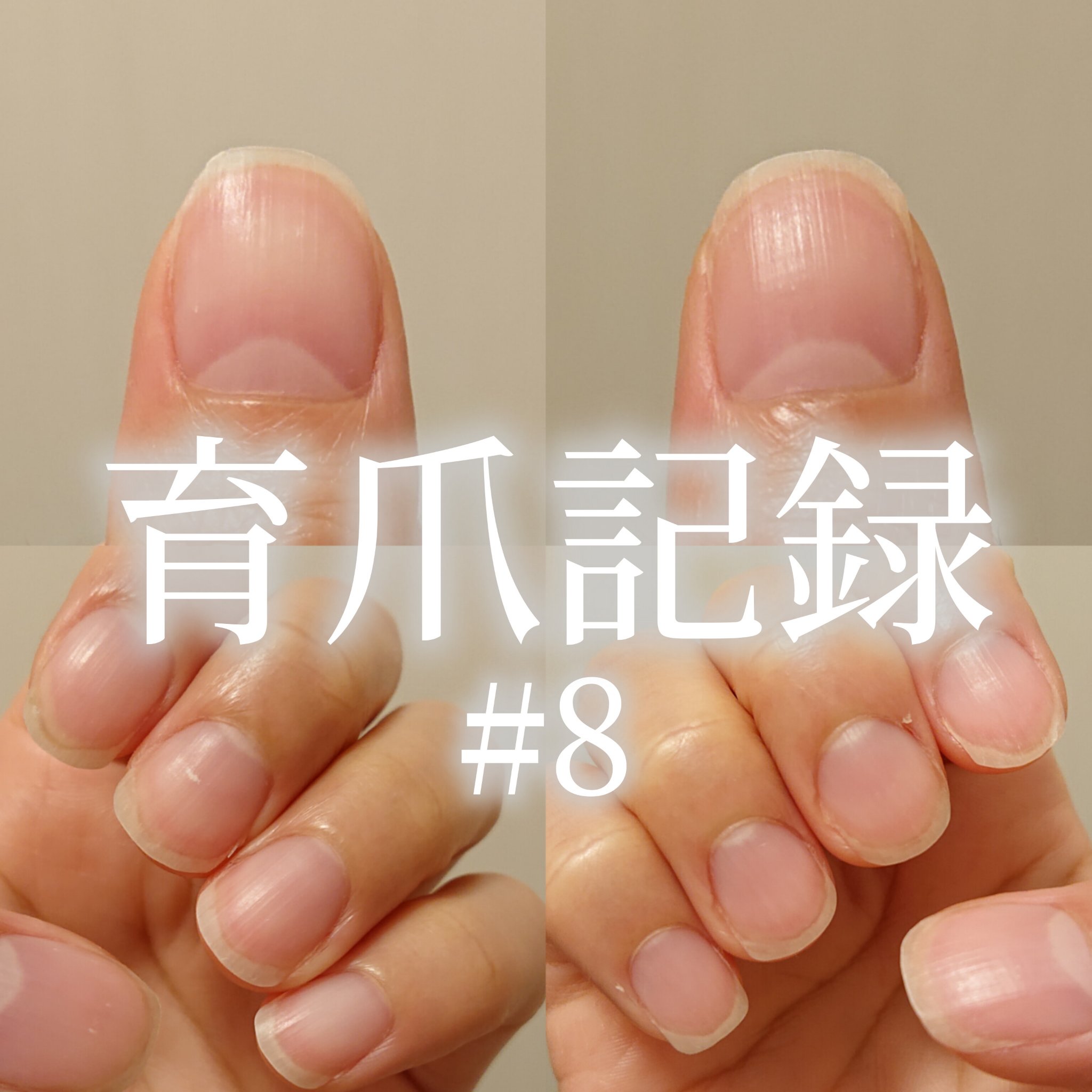 ネイルベッドオイル/アンドネイル/ネイルオイル・トリートメントを使ったクチコミ（1枚目）