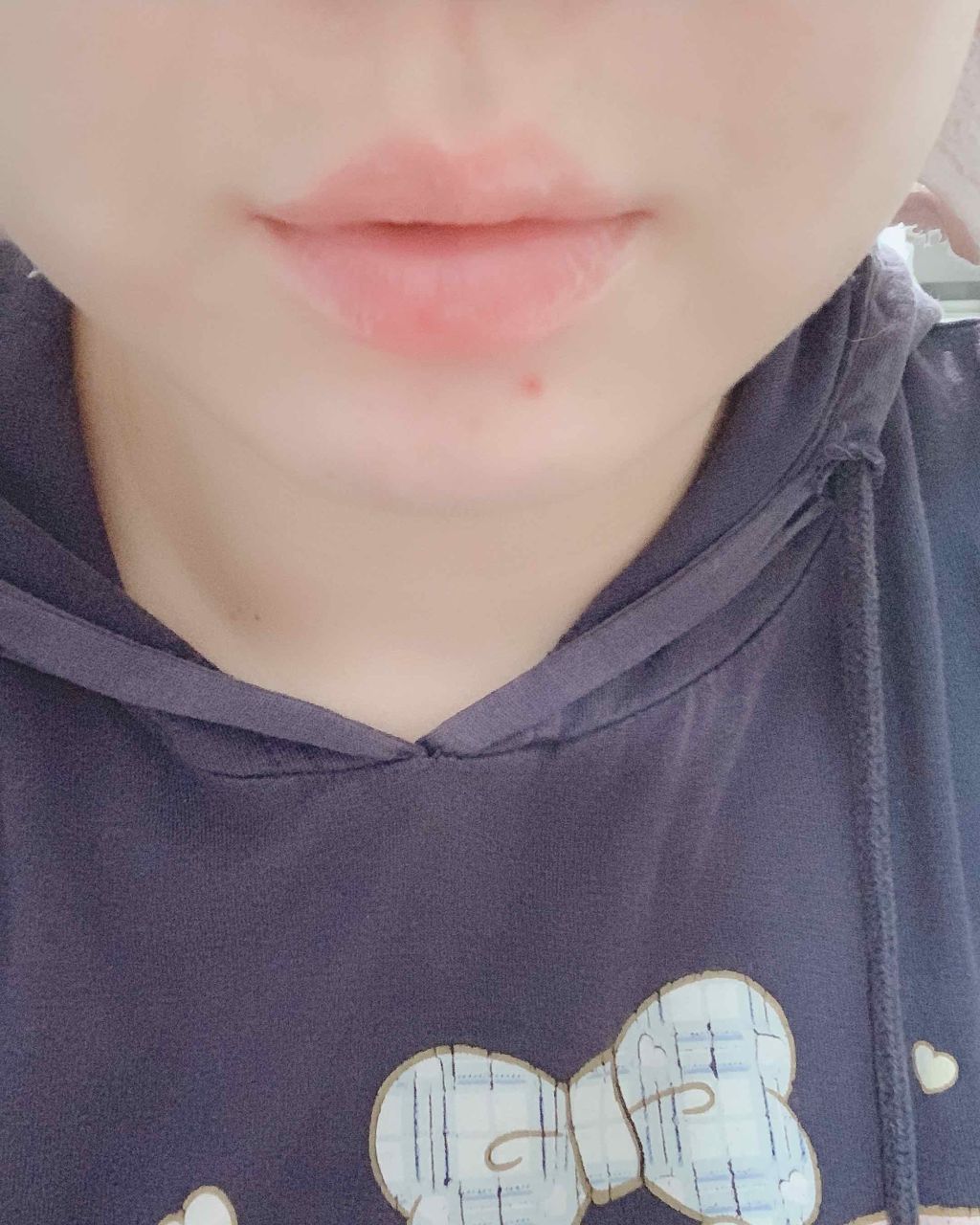 38°C / 99°F リップトリートメント (リップ美容液)/UZU BY FLOWFUSHI/リップケアを使ったクチコミ(3枚目)