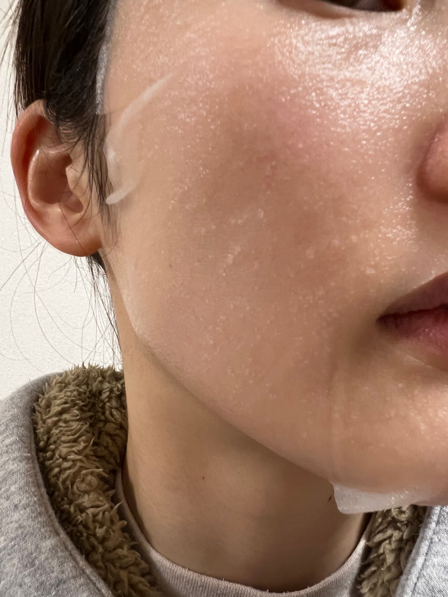 ダーマレーザー スーパー VC100 ホワイトマスク/クオリティファースト/シートマスク・パックを使ったクチコミ(3枚目)