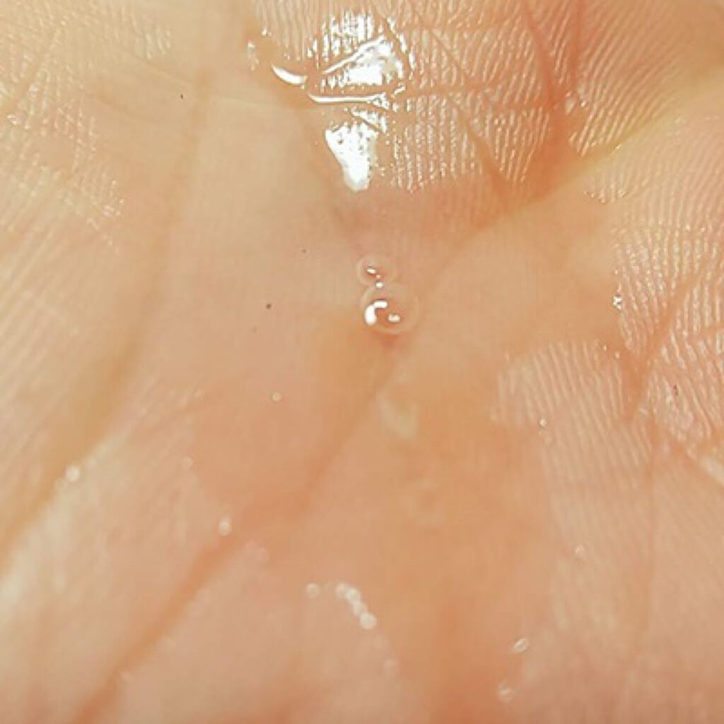 育毛エッセンス/セグレタ/頭皮ローションを使ったクチコミ（2枚目）