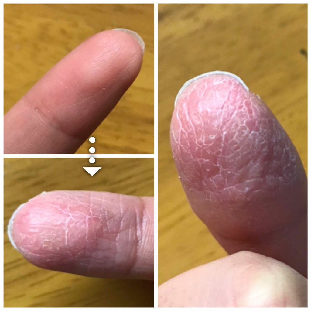 オイラックスPZリペア軟膏(医薬品)/オイラックス/その他を使ったクチコミ（2枚目）