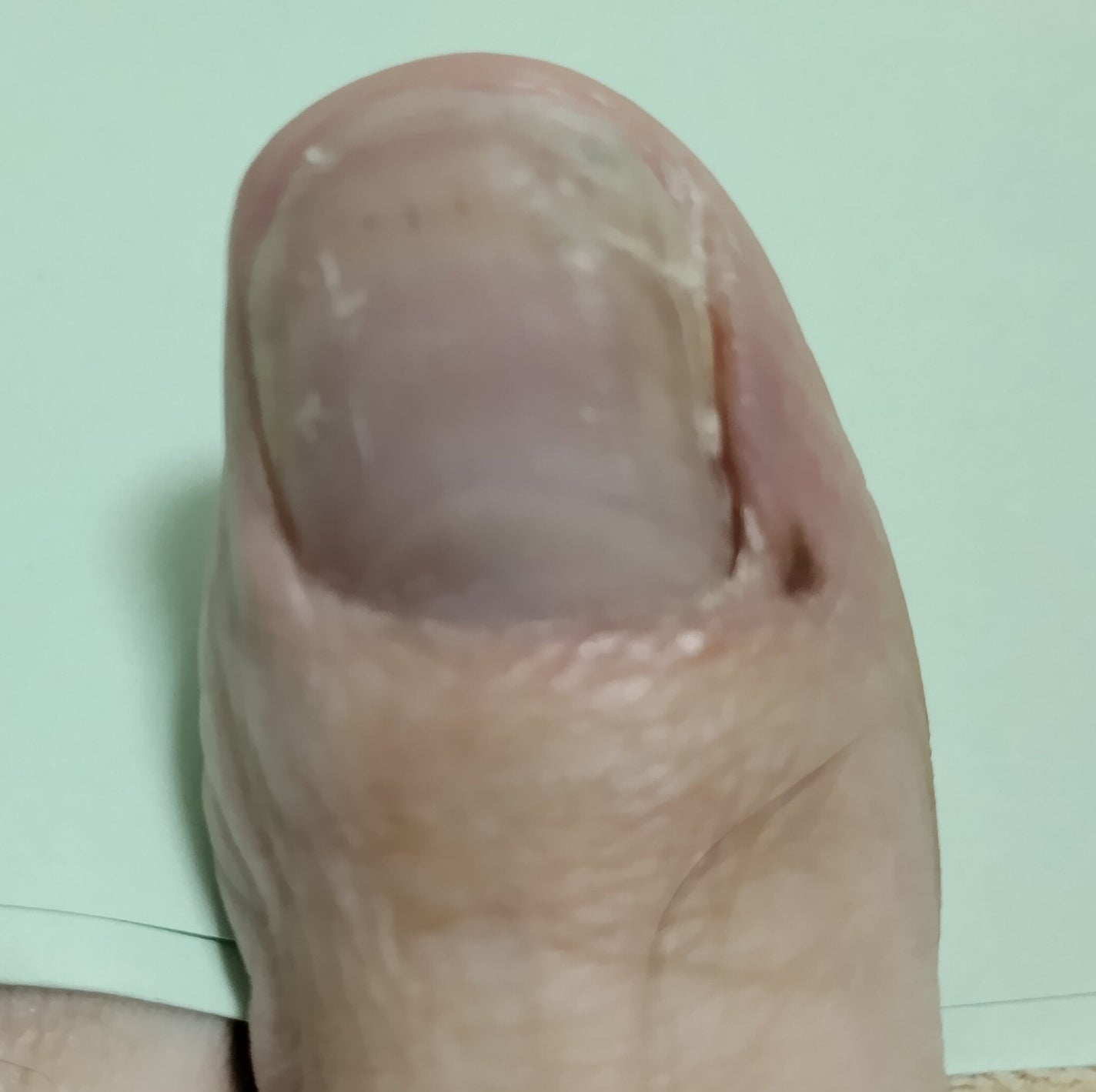 ネイル リペアセラム/ネイル リペアセラム/ネイルオイル・トリートメントを使ったクチコミ(2枚目)