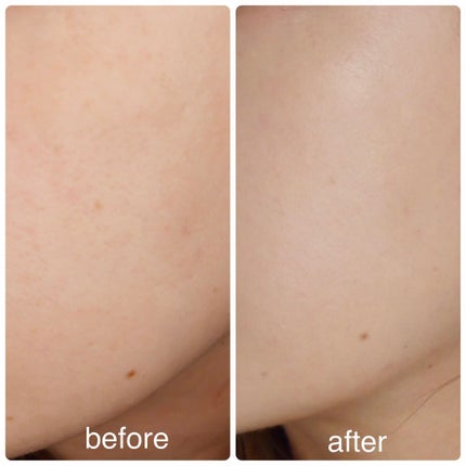 オールアワーズ リキッド/YVES SAINT LAURENT BEAUTE/リキッドファンデーションを使ったクチコミ(4枚目)