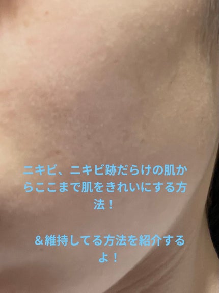 ハトムギ化粧水(ナチュリエ スキンコンディショナー R )/ナチュリエ/化粧水を使ったクチコミ(1枚目)