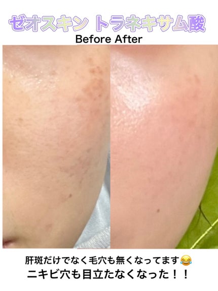 を使ったクチコミ(1枚目)