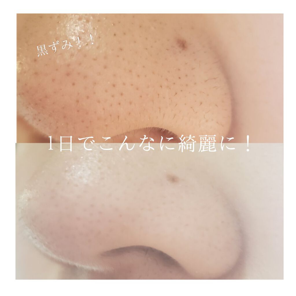 オリジナル ピュアスキンジェリー/ヴァセリン/ボディクリームを使ったクチコミ(1枚目)