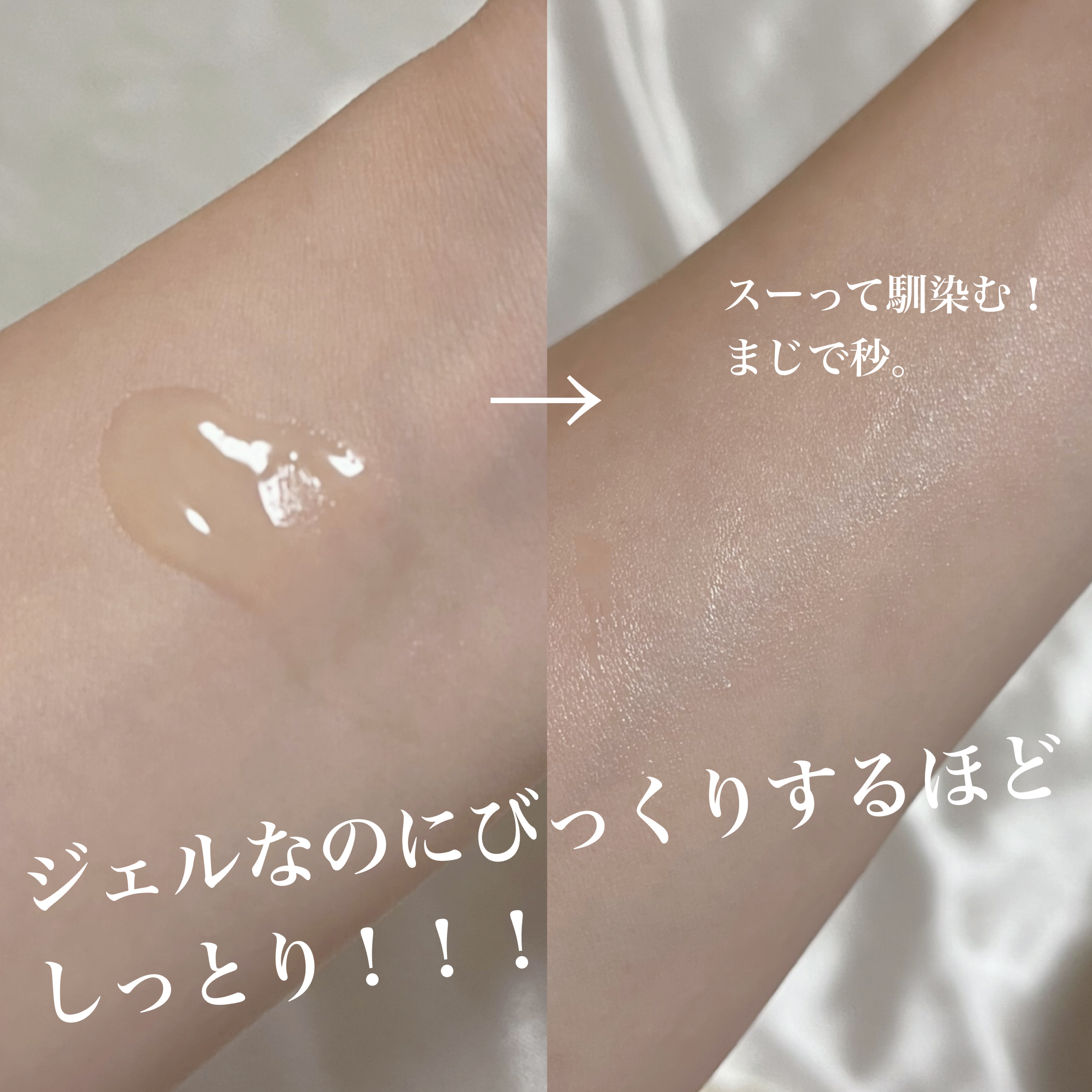 ダーマレーザー スーパーVC100ジェルクリーム/クオリティファースト/フェイスクリームを使ったクチコミ（3枚目）