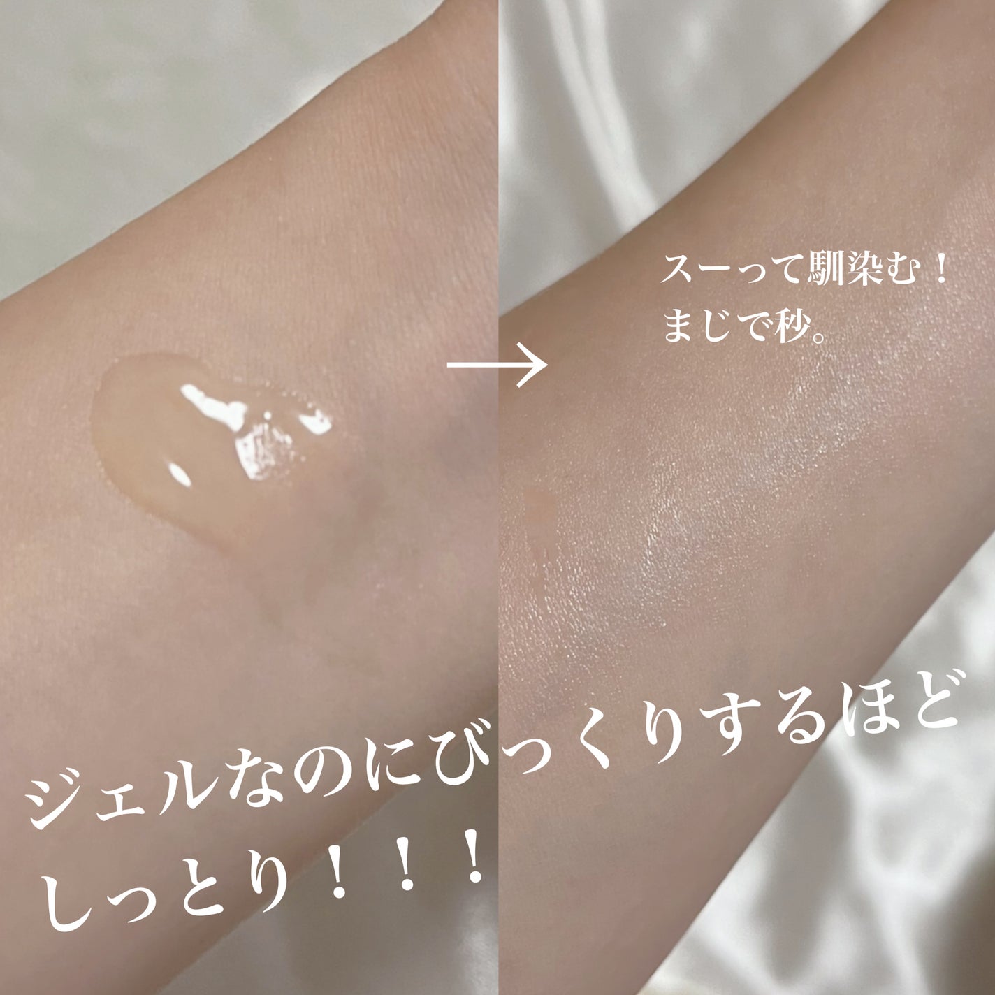 ダーマレーザー ウルセラC/クオリティファースト/美容液を使ったクチコミ(3枚目)