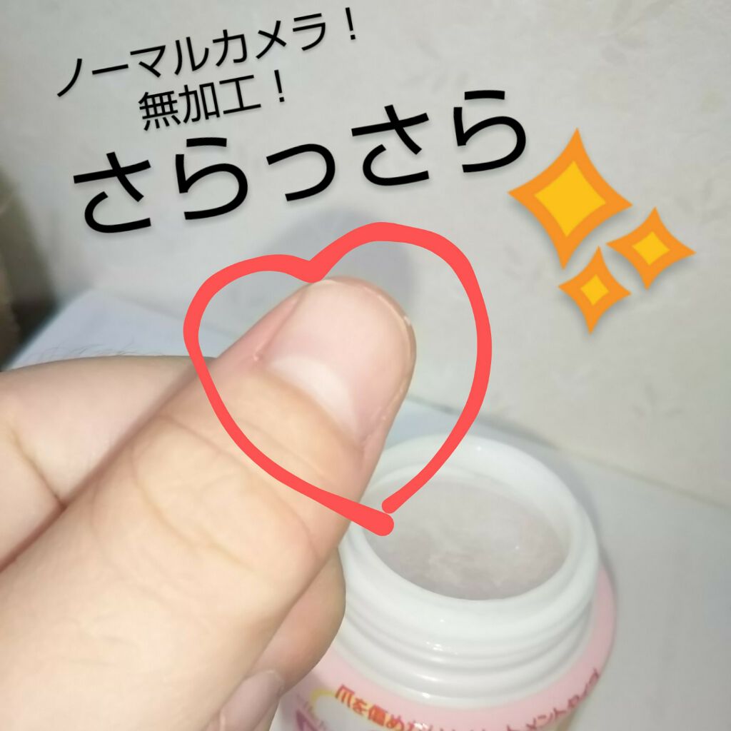 エルファー ネイルキッスB/DAISO/除光液を使ったクチコミ（3枚目）