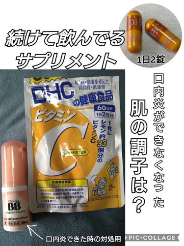 チョコラBB 口内炎リペアショット（医薬品）/チョコラBB/その他を使ったクチコミ（1枚目）