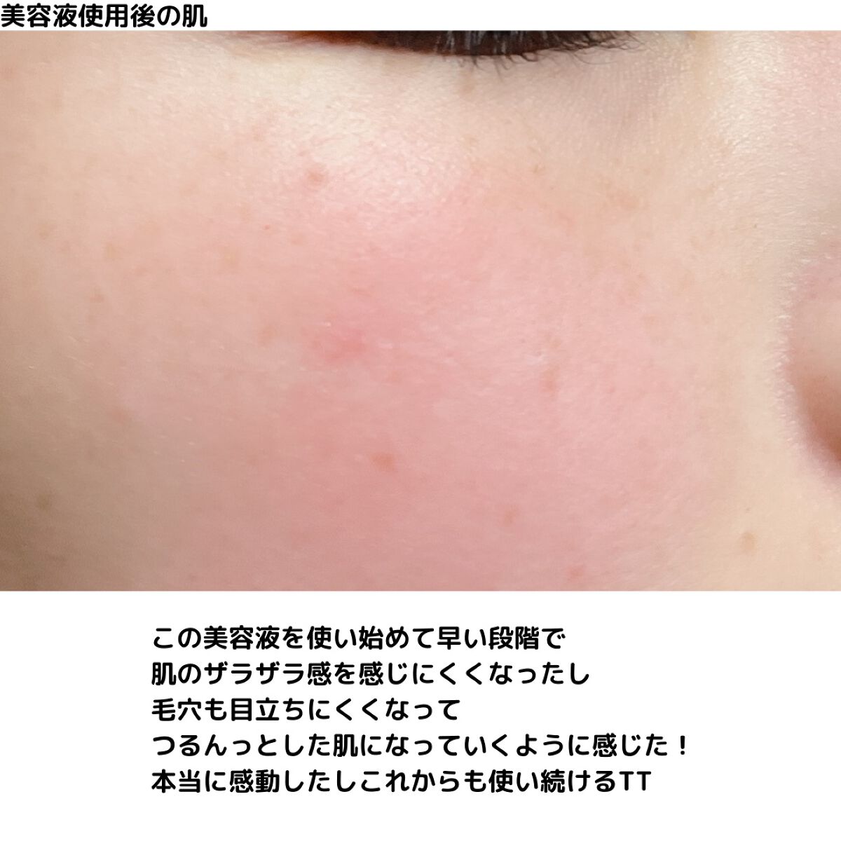 ザビタミンC23/IOPE/美容液を使ったクチコミ(7枚目)