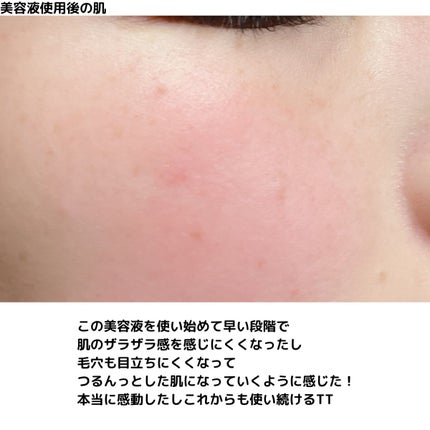 ザビタミンC23/IOPE/美容液を使ったクチコミ(7枚目)