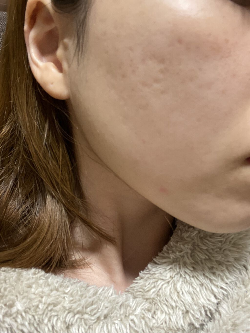 アピットジェル/全薬工業/美容液を使ったクチコミ（2枚目）