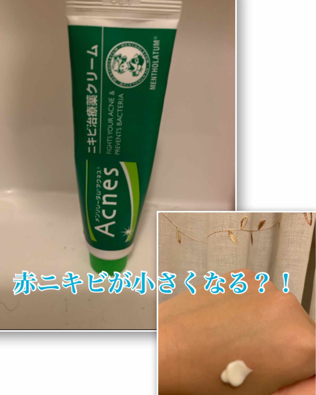 薬用保湿化粧水/オードムーゲ/化粧水を使ったクチコミ(1枚目)