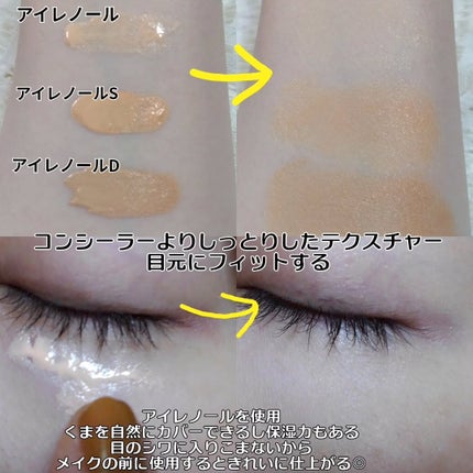 アイレノール クマクリーム/IRENOL/アイケア・アイクリームを使ったクチコミ(3枚目)