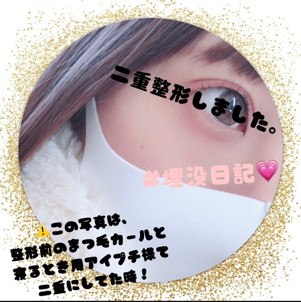 ♡. on LIPS 「実は私、2月5日金曜日に…二重整形してきました👏🏻👏🏻詳しく知..」(1枚目)