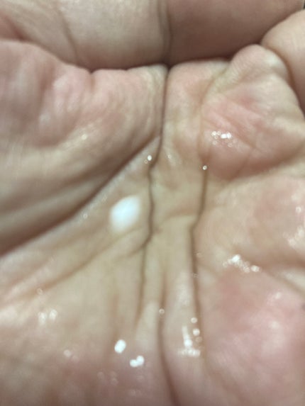 薬用しみ対策 美白化粧水/メラノCC/化粧水を使ったクチコミ(5枚目)