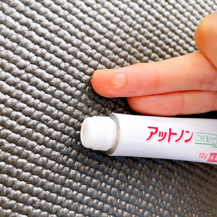 ニキビあとケアジェル/アットノン/その他スキンケアを使ったクチコミ(2枚目)