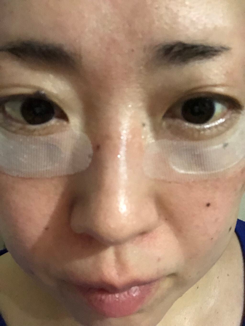 プロテオフィルパッチ/METLLASSE(メトラッセ)/シートマスク・パックを使ったクチコミ(5枚目)