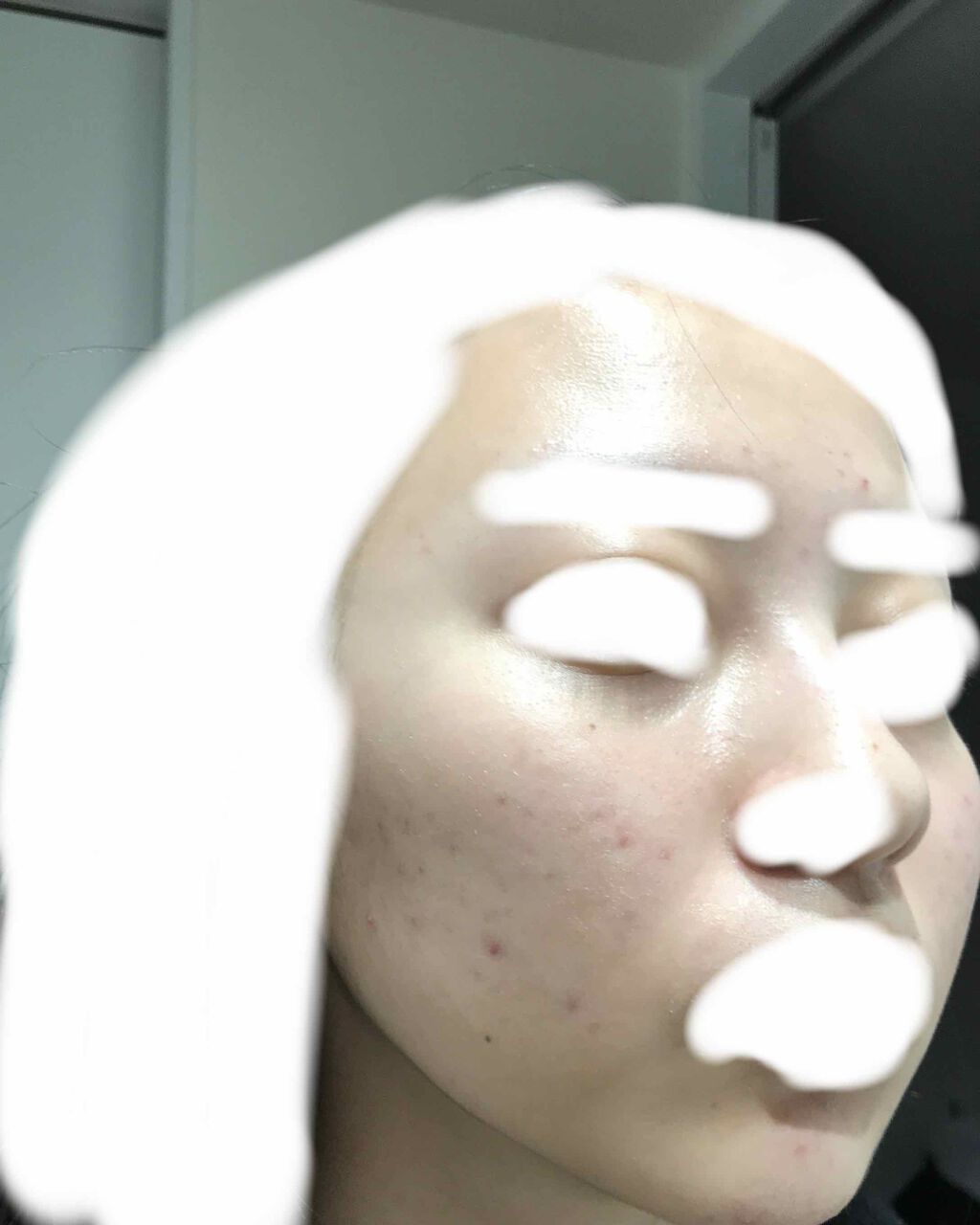 十味敗毒湯(医薬品)/ツムラ/その他を使ったクチコミ（2枚目）