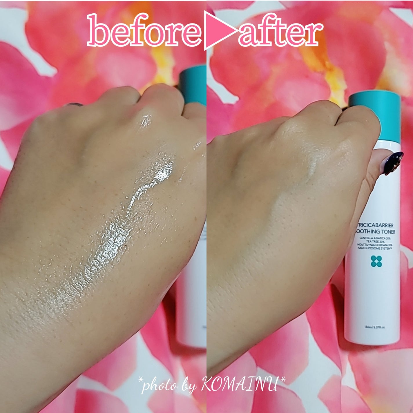 トリシカバリアスージングトナー/SKIN&LAB/化粧水を使ったクチコミ(4枚目)