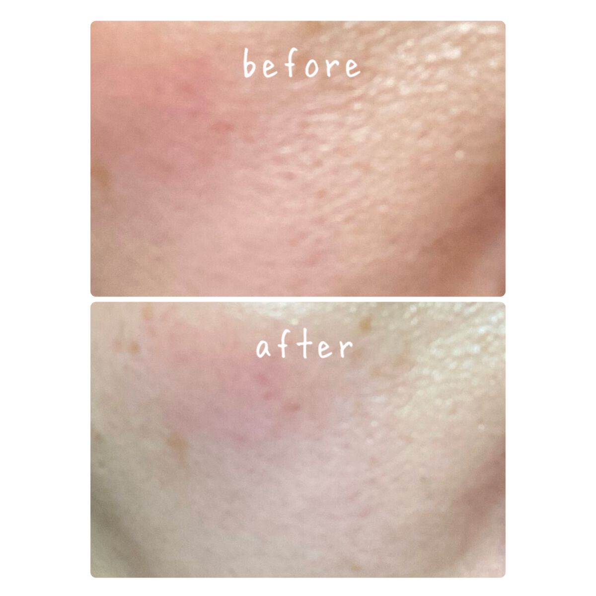 レチノールインテンスリアクティベーションセラム/SOME BY MI/美容液を使ったクチコミ（3枚目）