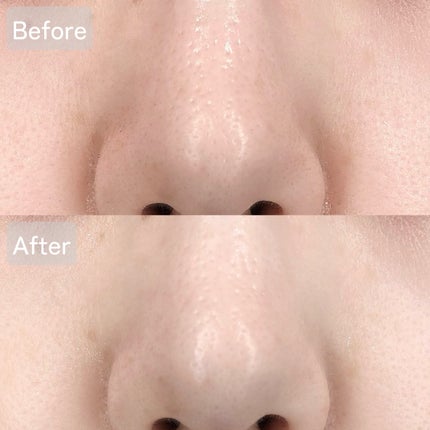 アンチポアブラックヘッドパーフェクトクリアキット/CNP Laboratory/シートマスク・パックを使ったクチコミ(4枚目)