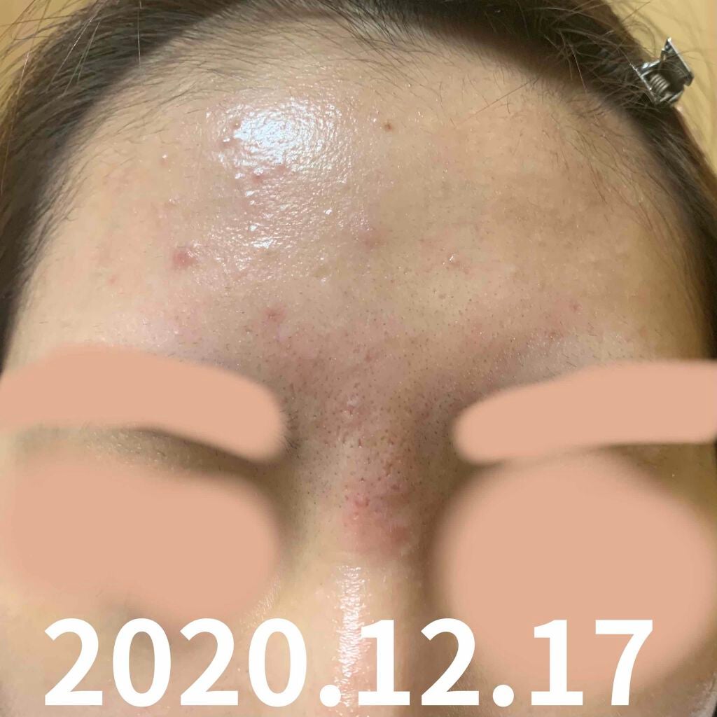 モイスチャージェル2/エンビロン/フェイスクリームを使ったクチコミ(3枚目)