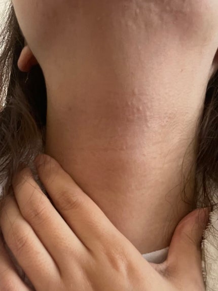 rina on LIPS ãðšç·æ¥ðšåç²§æ°Žã§ãã¶ãããšãããŒãªããŸããç«ç
§ããã§ãããããª..ãïŒ1æç®ïŒ