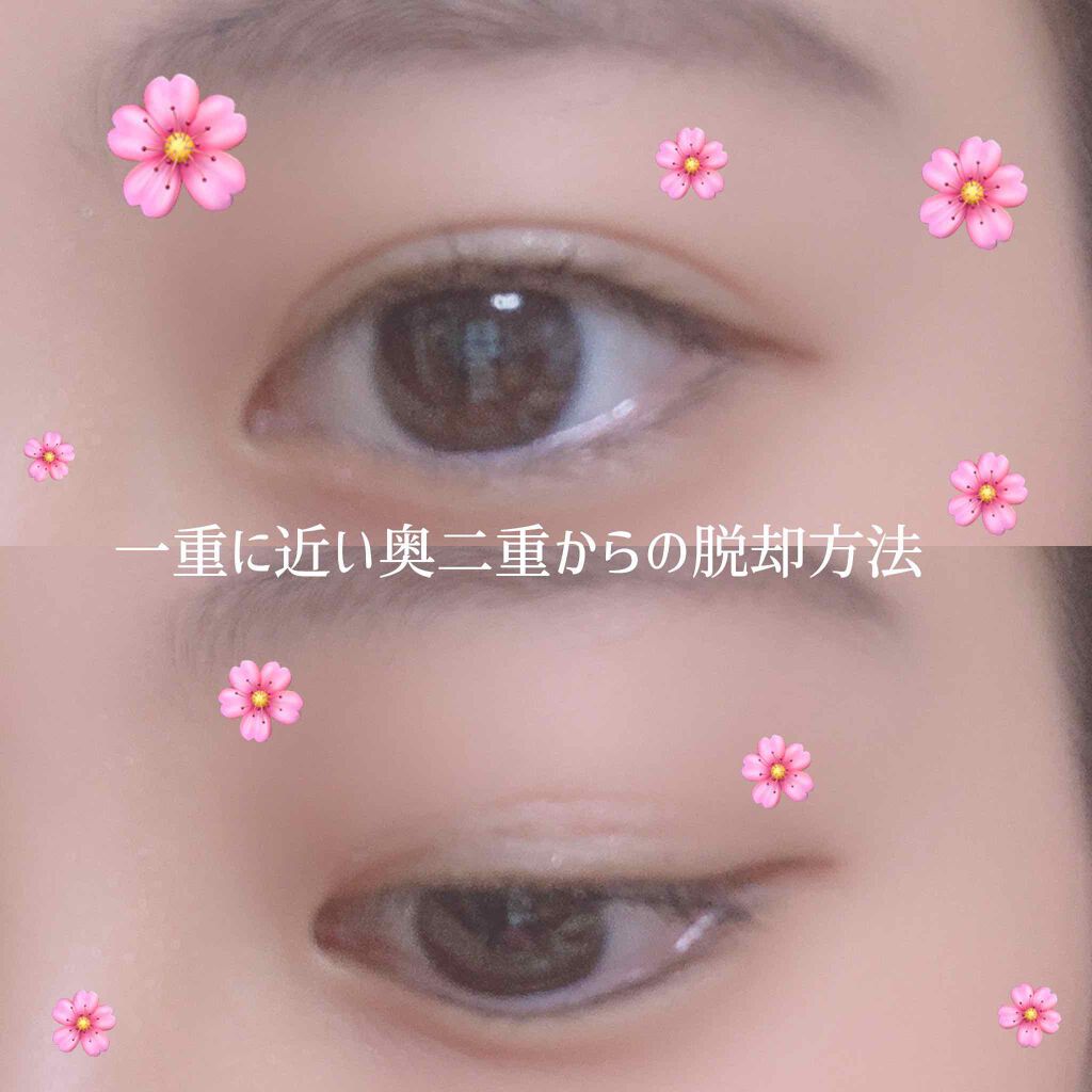 アイトーク/アイトーク/二重まぶた用アイテムを使ったクチコミ(1枚目)