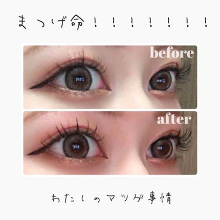 アヴァンセ ラッシュセラム EX(医薬部外品)/アヴァンセ/その他を使ったクチコミ(1枚目)