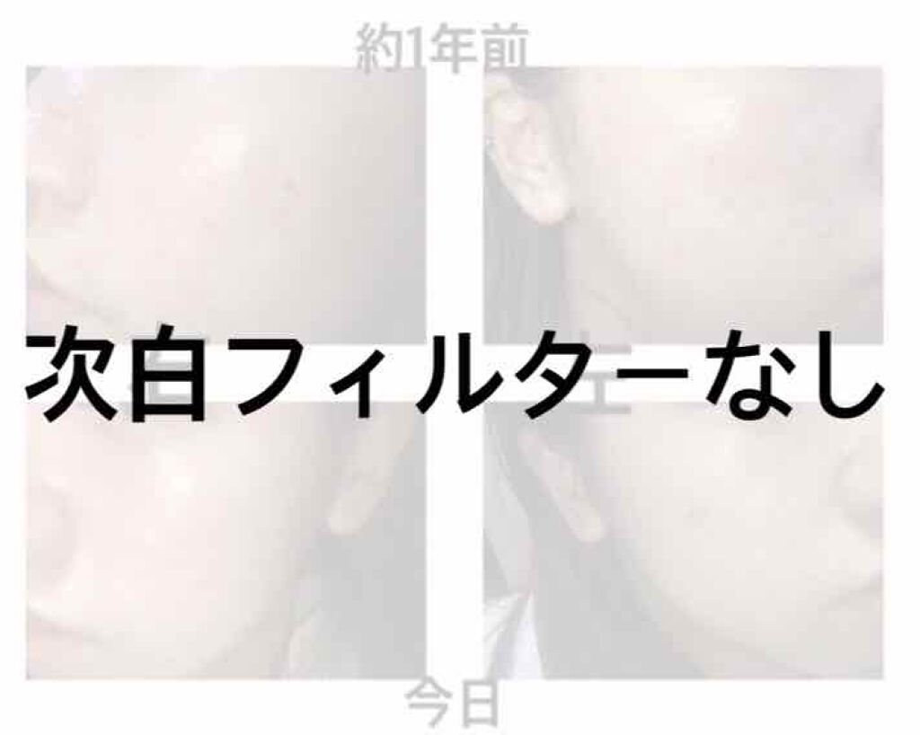 ガラクトミー ナイアシンエッセンス/manyo/美容液を使ったクチコミ（1枚目）