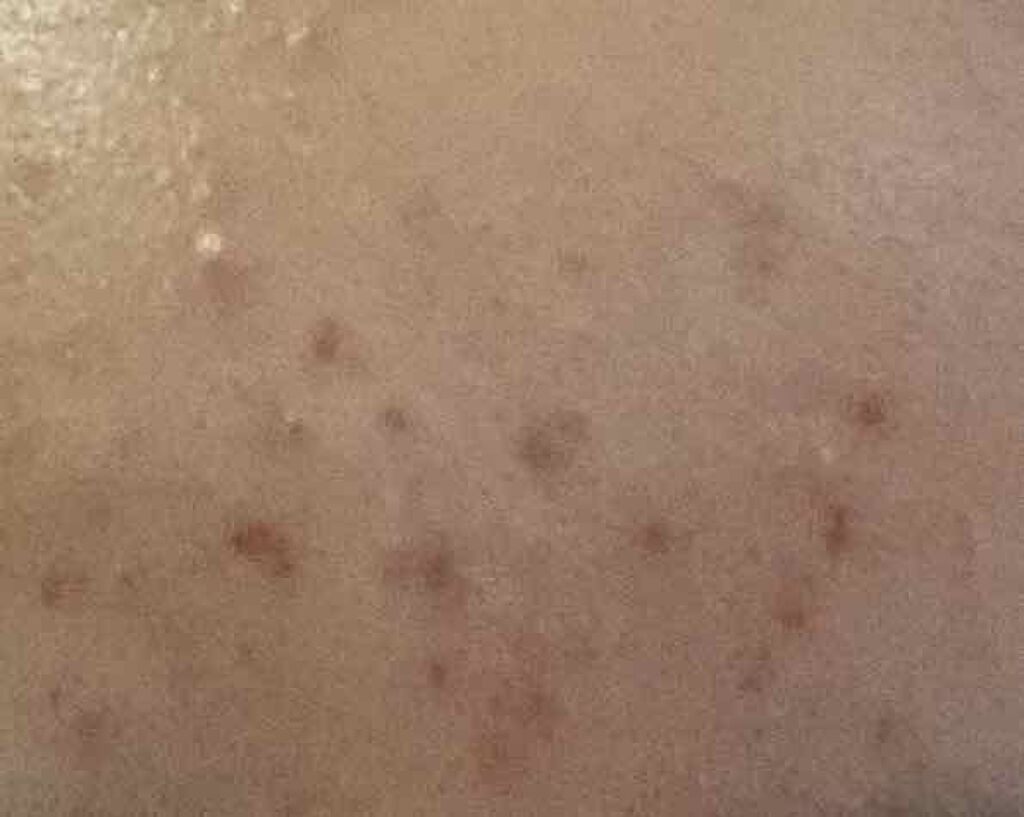 クレンジングオイル/muo/オイルクレンジングを使ったクチコミ（2枚目）