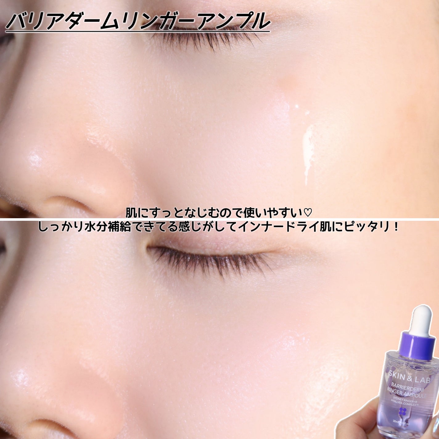 バリアダームリンガーアンプル/SKIN&LAB/美容液を使ったクチコミ(5枚目)