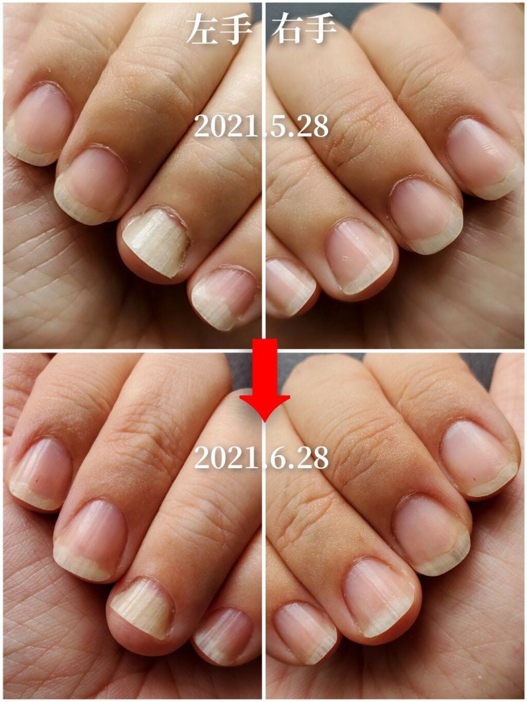 ネイルベッドオイル/アンドネイル/ネイルオイル・トリートメントを使ったクチコミ(3枚目)