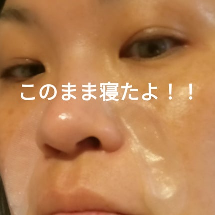フィルナチュラント IC.U  HA  マイクロパッチ/ドクターフィルコスメティクス/シートマスク・パックを使ったクチコミ(3枚目)