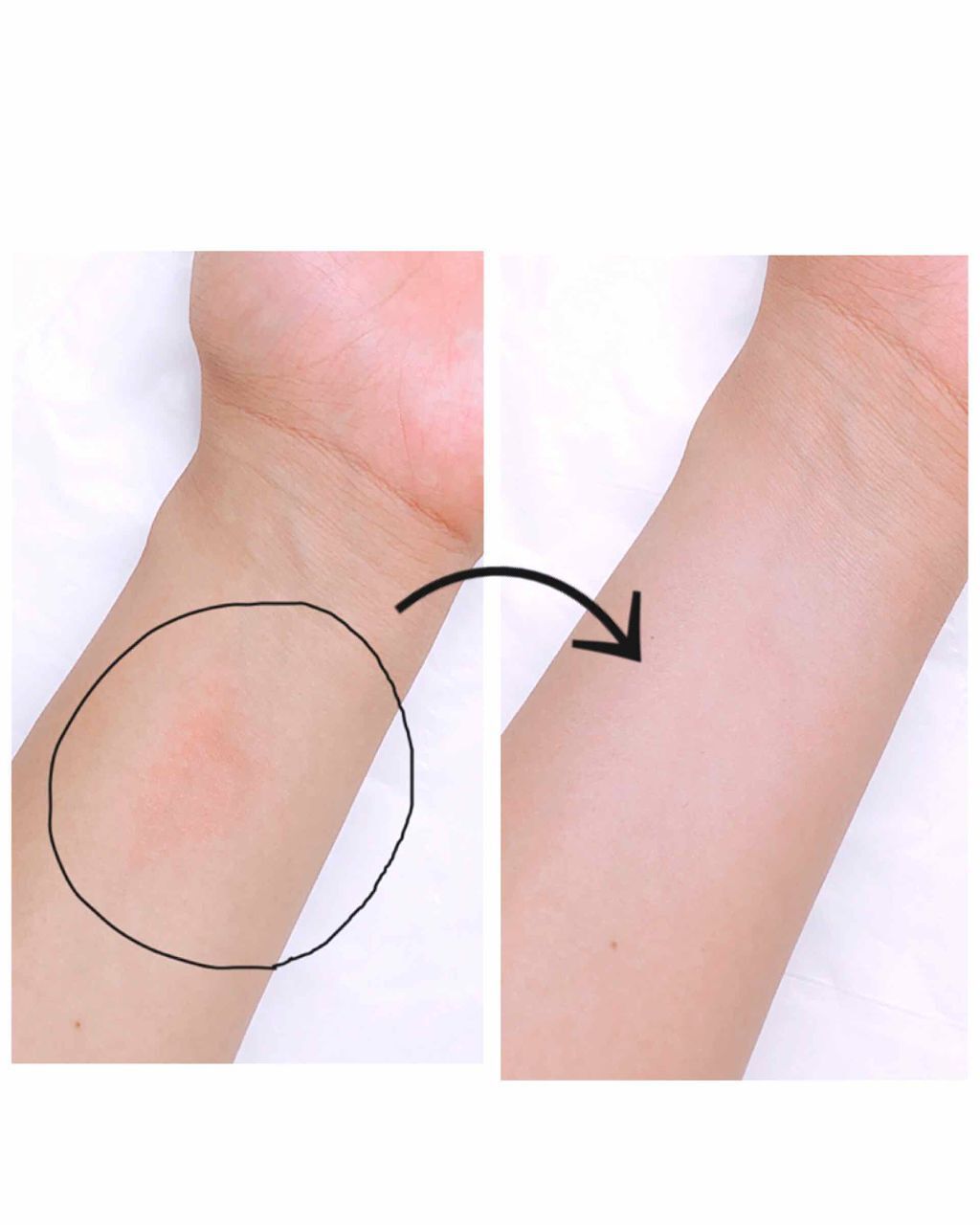 サイレントグロウ コンシーラー SG03 ミントグロウ/excel/リキッドコンシーラーを使ったクチコミ（2枚目）