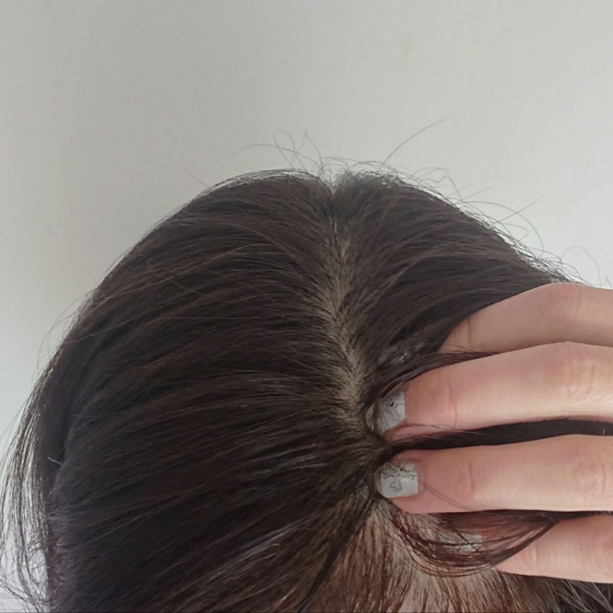 メディケイテッドスカルプフォーム/GROW LAB/頭皮ローションを使ったクチコミ（3枚目）