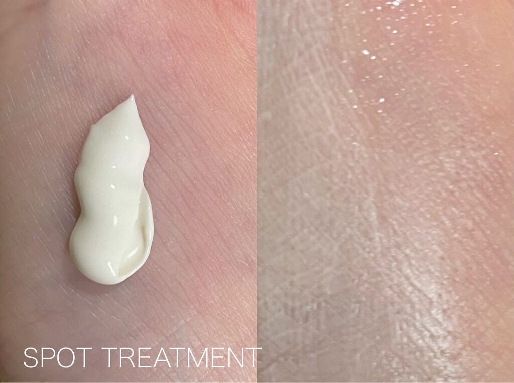 シカテロルクリーム/beplain/フェイスクリームを使ったクチコミ(7枚目)