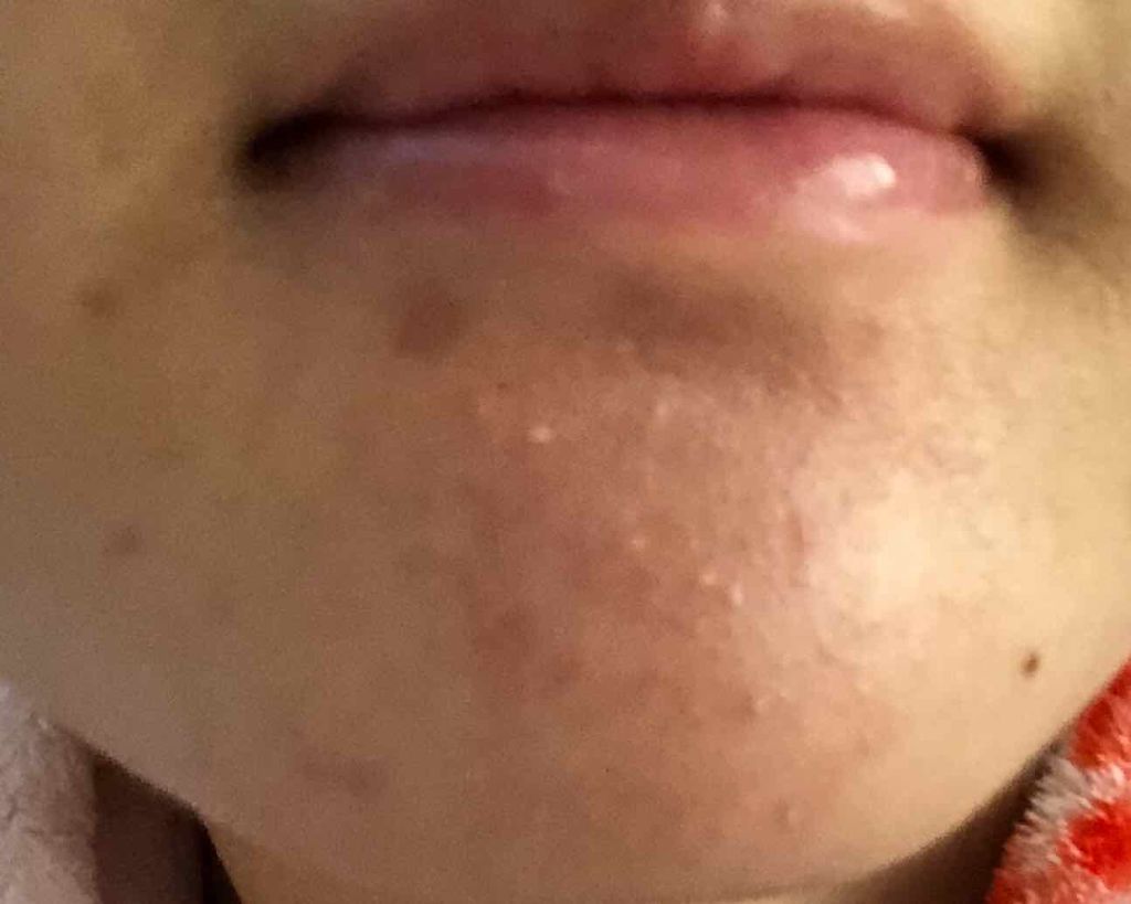 ウオーター/アベンヌ/ミスト状化粧水を使ったクチコミ(2枚目)