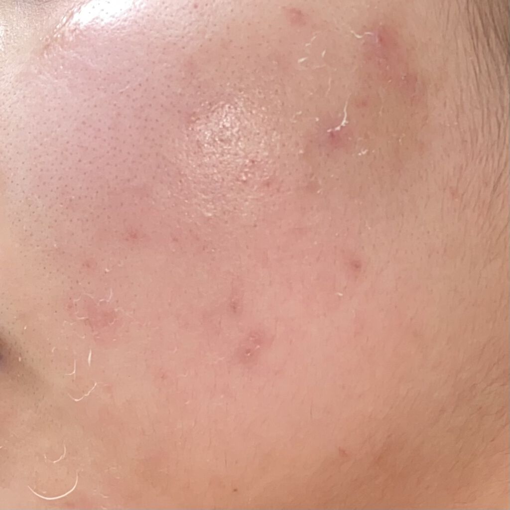 を使ったクチコミ（3枚目）