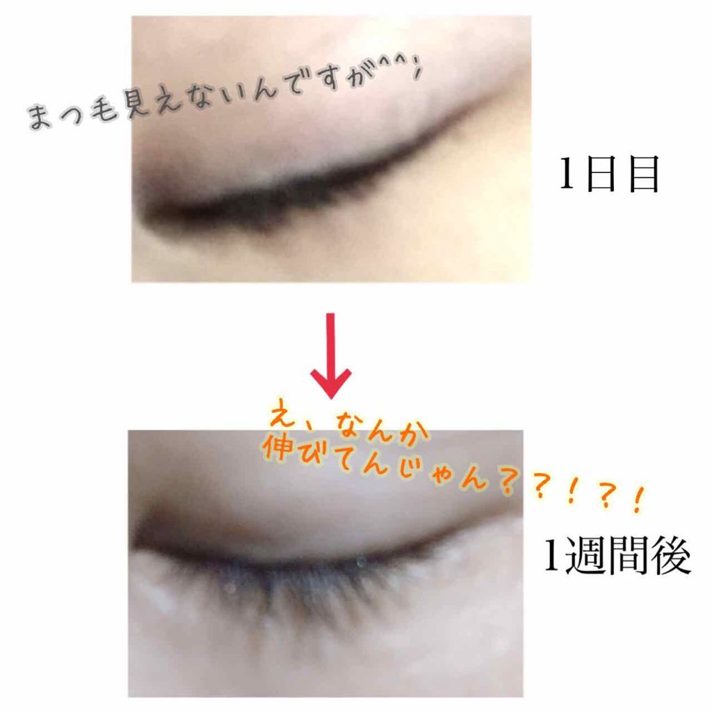 ローヤルゼリー配合 栄養ローション/DAISO/美容液を使ったクチコミ(3枚目)