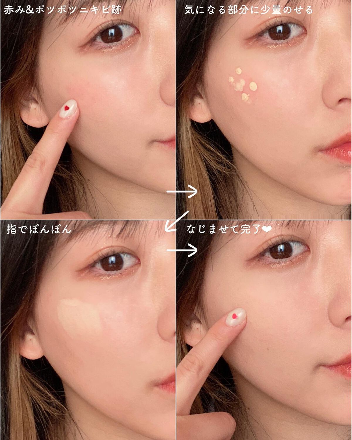 イプノス シーバムクリア リペアクリーム/ACSEINE/フェイスクリームを使ったクチコミ(5枚目)