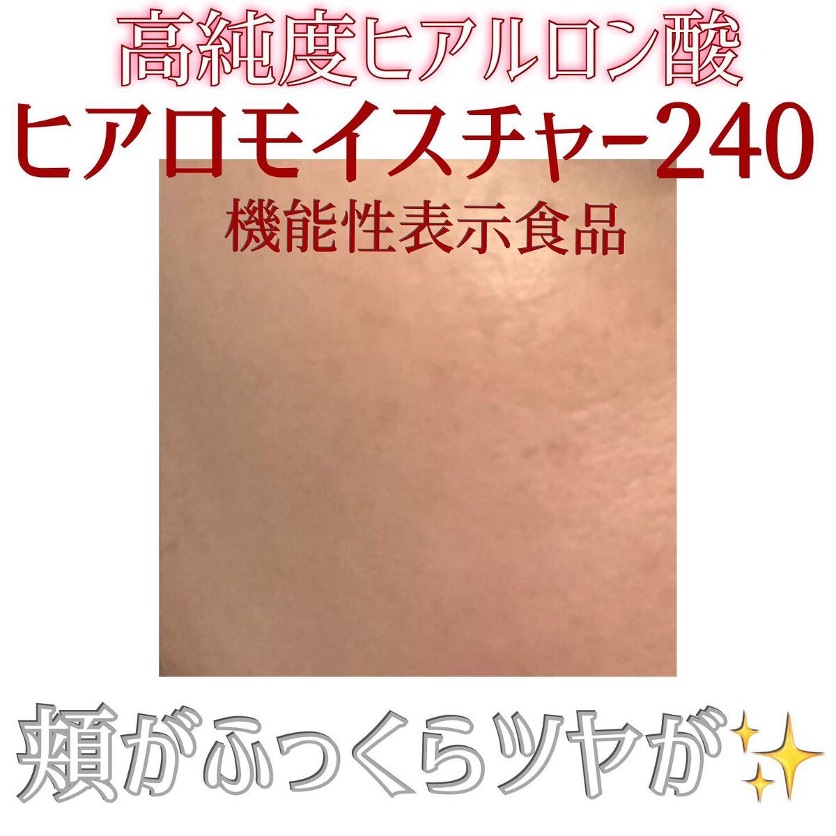 ヒアロモイスチャー240/キユートピア/美容サプリメントを使ったクチコミ（2枚目）