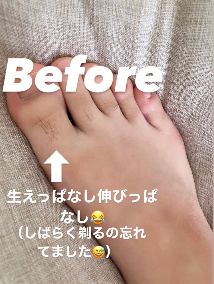 フェイス&ボディシェーバー KLC-0720/KOIZUMI/シェーバーを使ったクチコミ(3枚目)