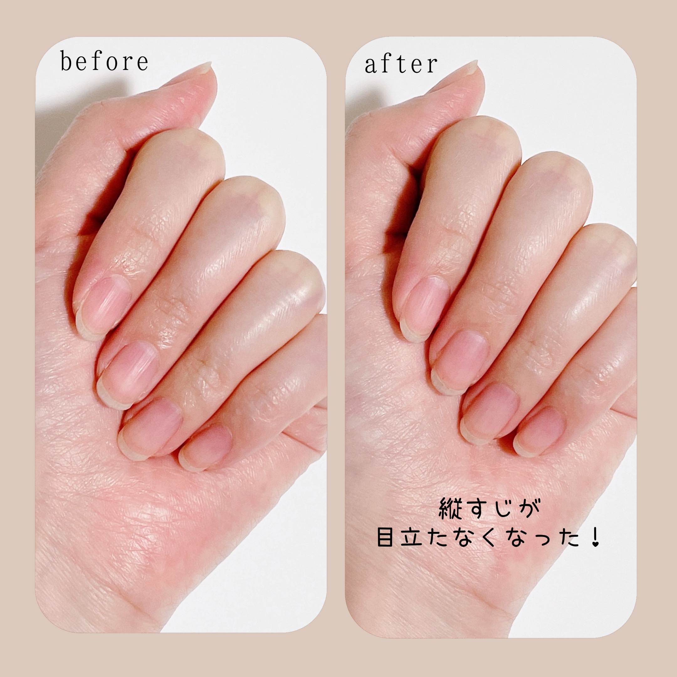 リペア セラム/ネイルホリック/ネイルオイル・トリートメントを使ったクチコミ（2枚目）