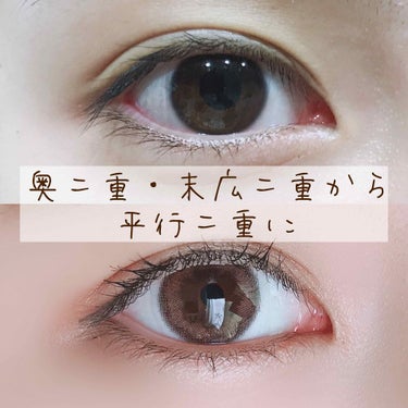 整形なし 奥二重から二重にする方法 アイプチ テープ おすすめアイテムもpick Up Lips 整形なし 奥二重から二重にする方法 アイプチ テープ おすすめアイテムもpick Up Lips