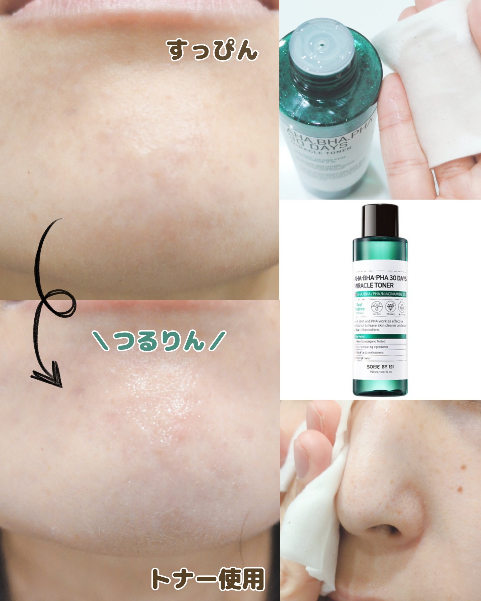 AHA·BHA·PHA 30デイズミラクルクリーム/SOME BY MI/フェイスクリームを使ったクチコミ（3枚目）